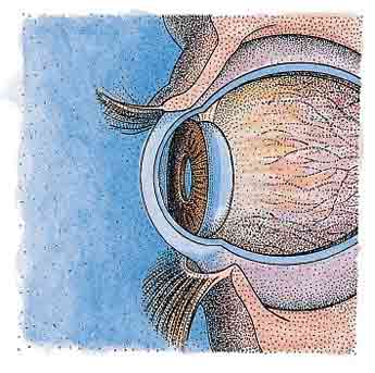 corneal foreign bodies