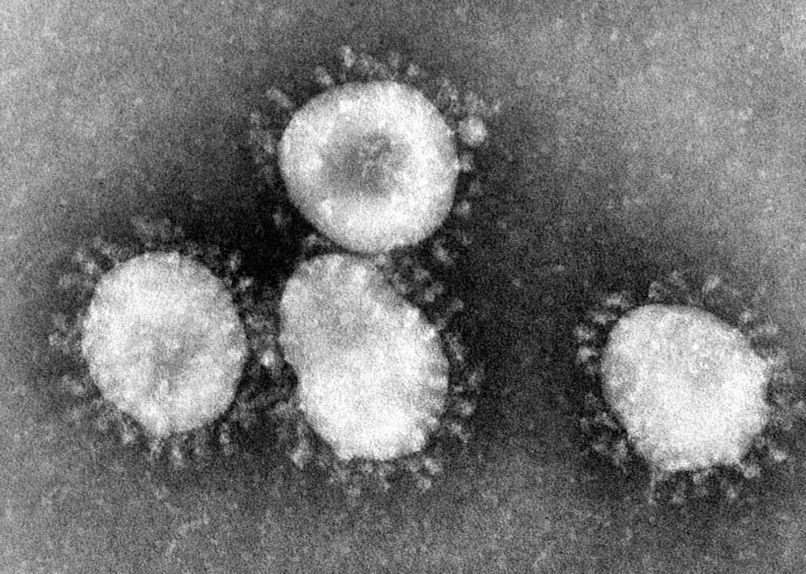 Microscopic image of Coronavirus
