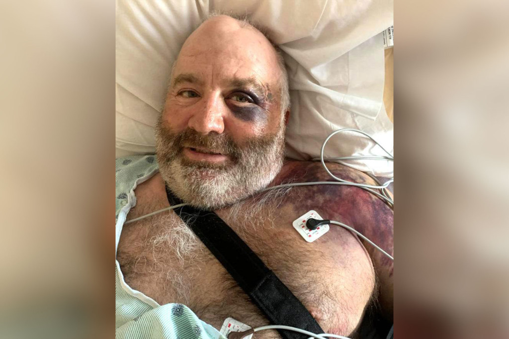 A Wyoming rancher was pinned under his ATV for two days, but survived on beer and water.