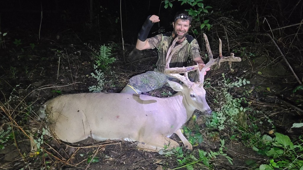 After falling from a ladder, this Kentucky hunter had success during Kentucky's early bow season.