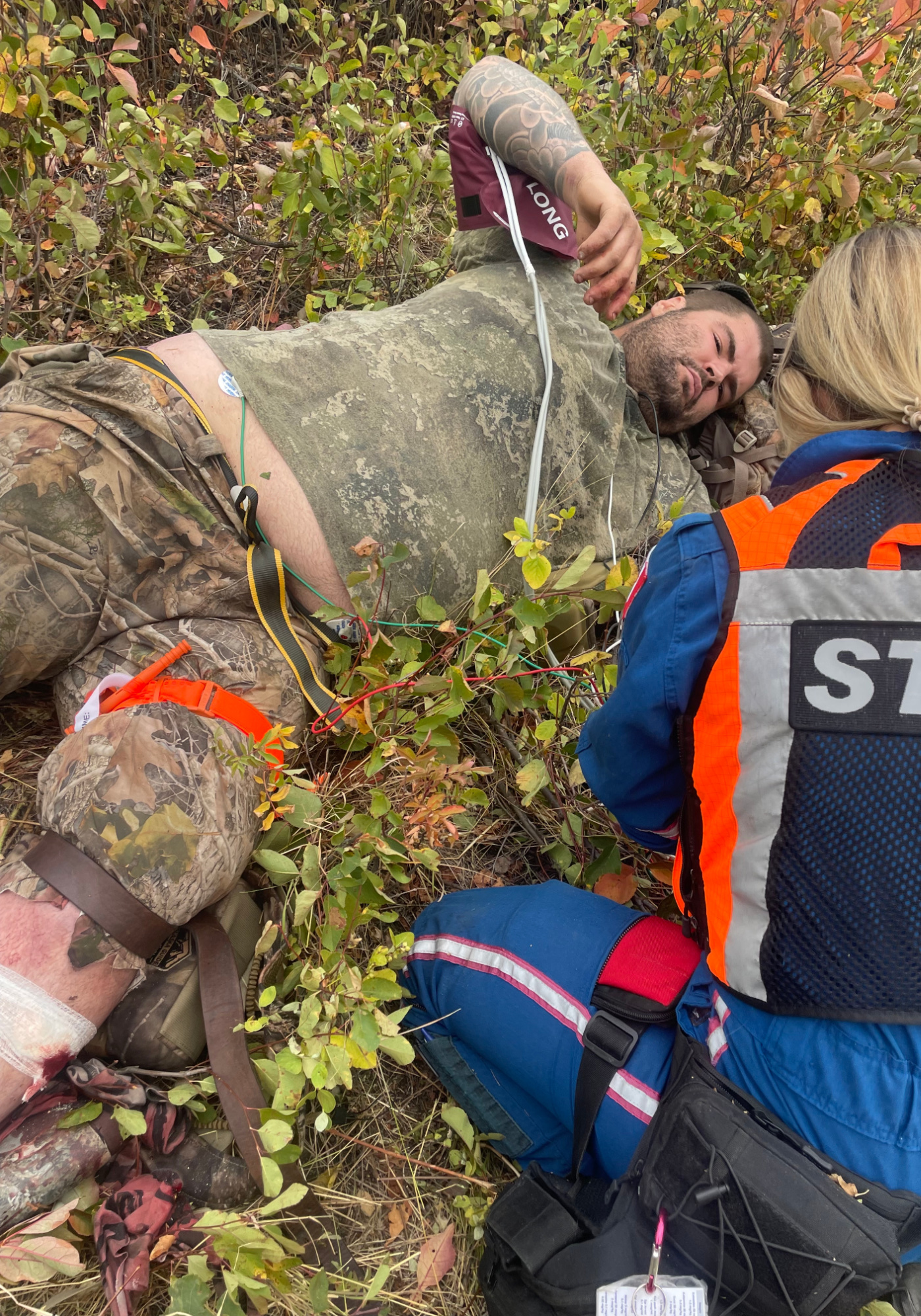 “10 Inches of Arrow Were in My Leg.” Bowhunter Suffers Freak Accident on Elk Hunt