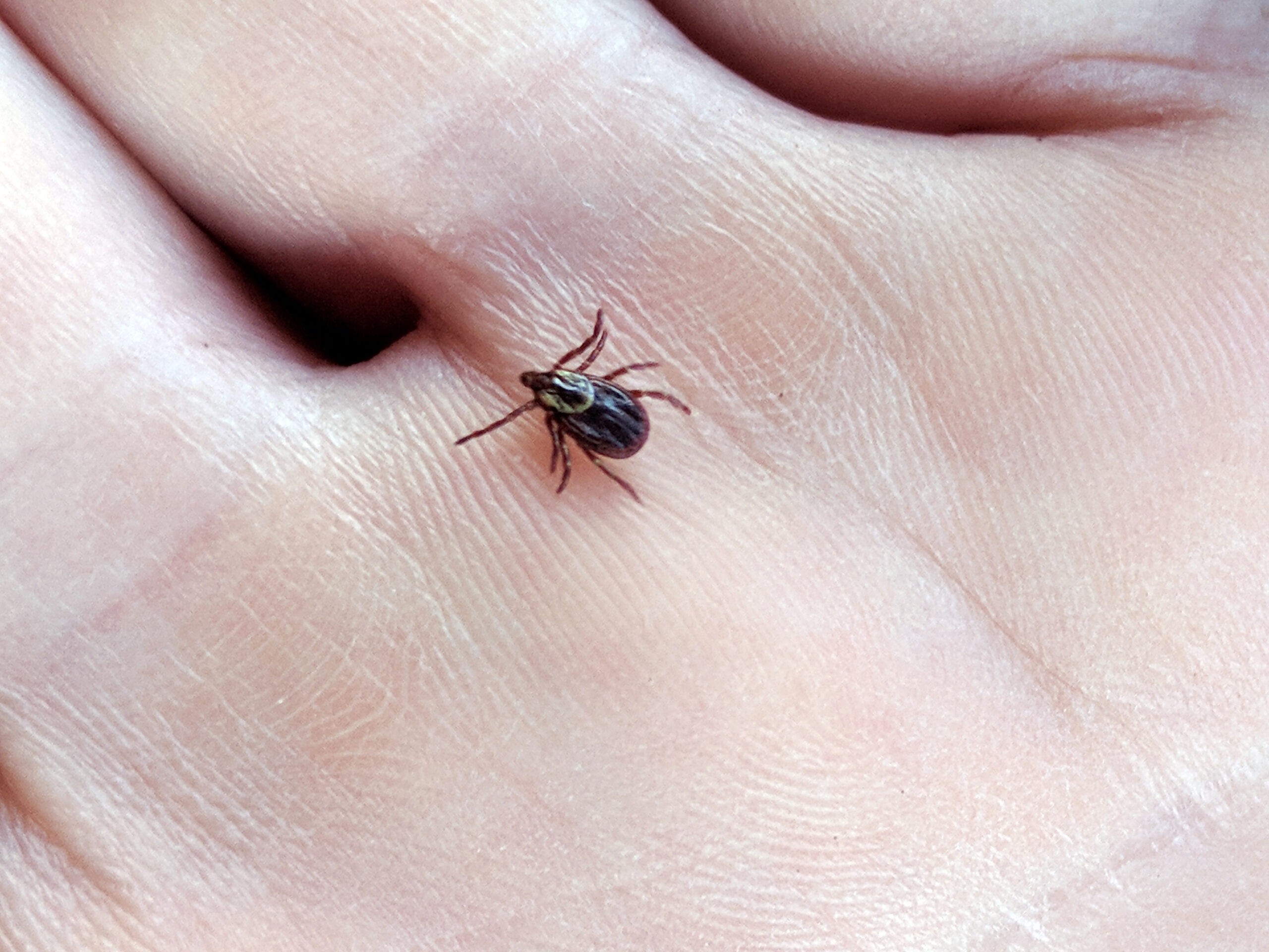 An American dog tick can carry diseases to hunters.