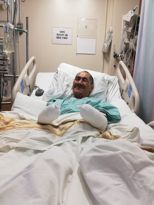 Nunavut Hunter Survives 5-Day Blizzard, Loses Both Hands to Frostbite
