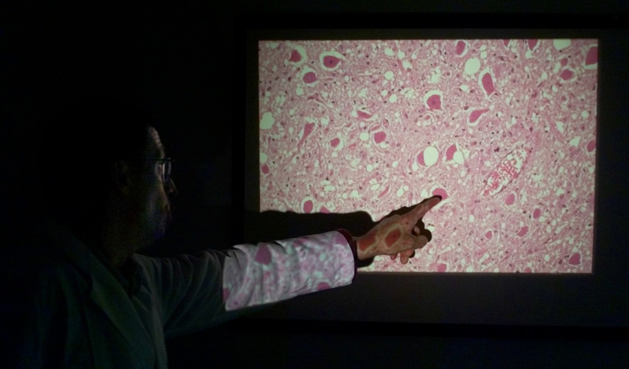 What CWD Researchers Can't Say on the Record