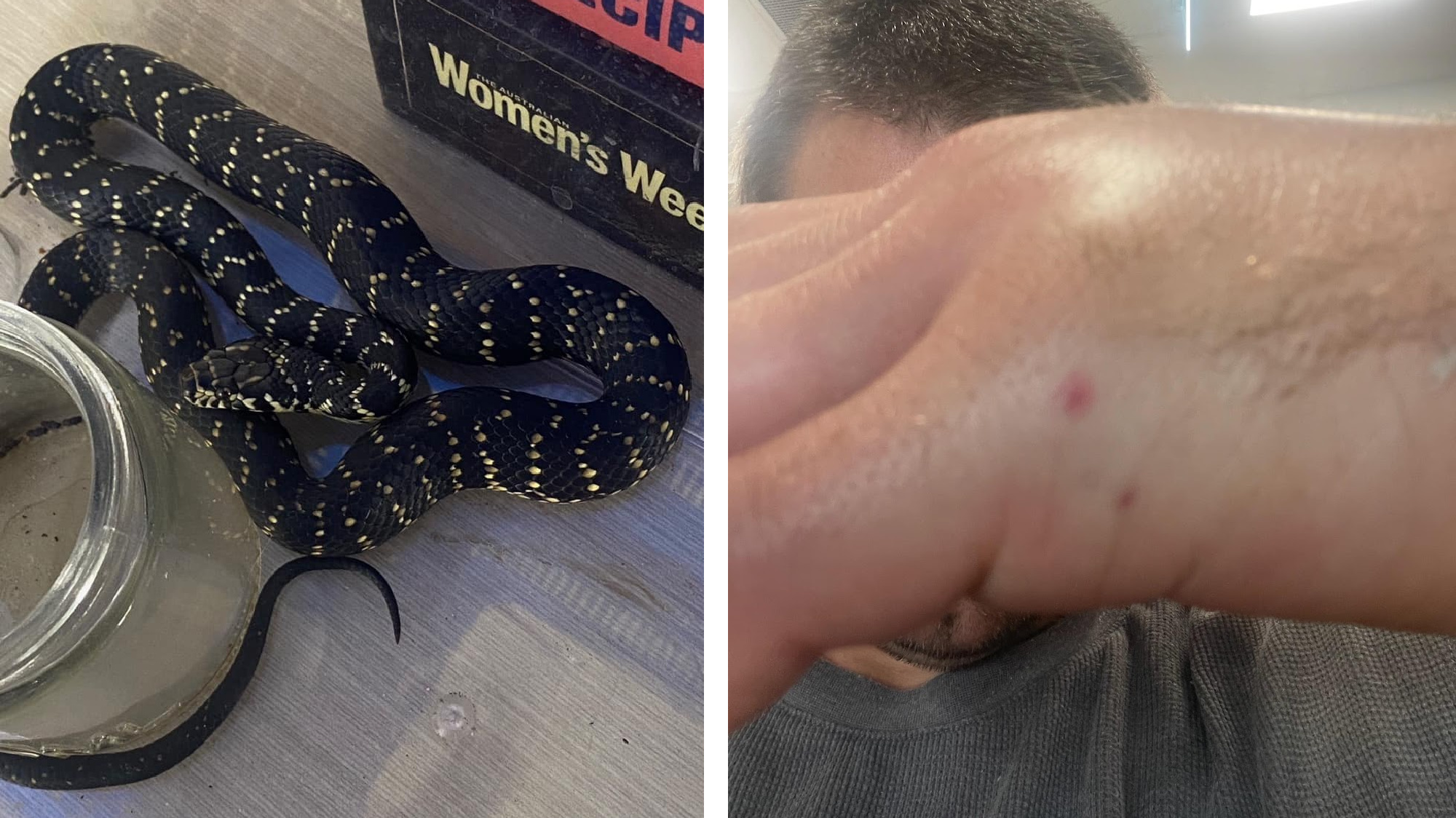 broad-headed snake and venomous bite