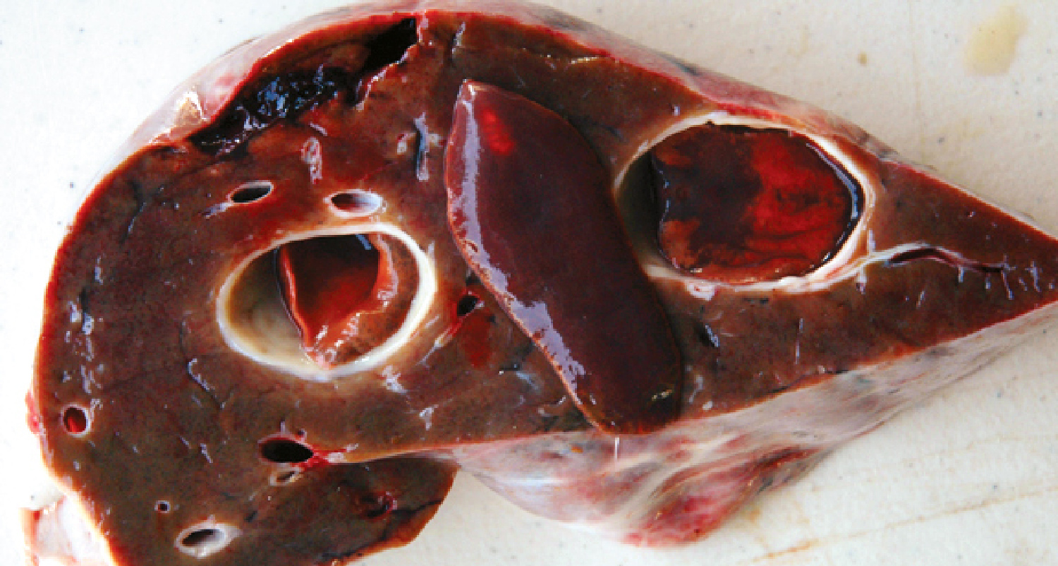 A deer's liver with flukes inside.