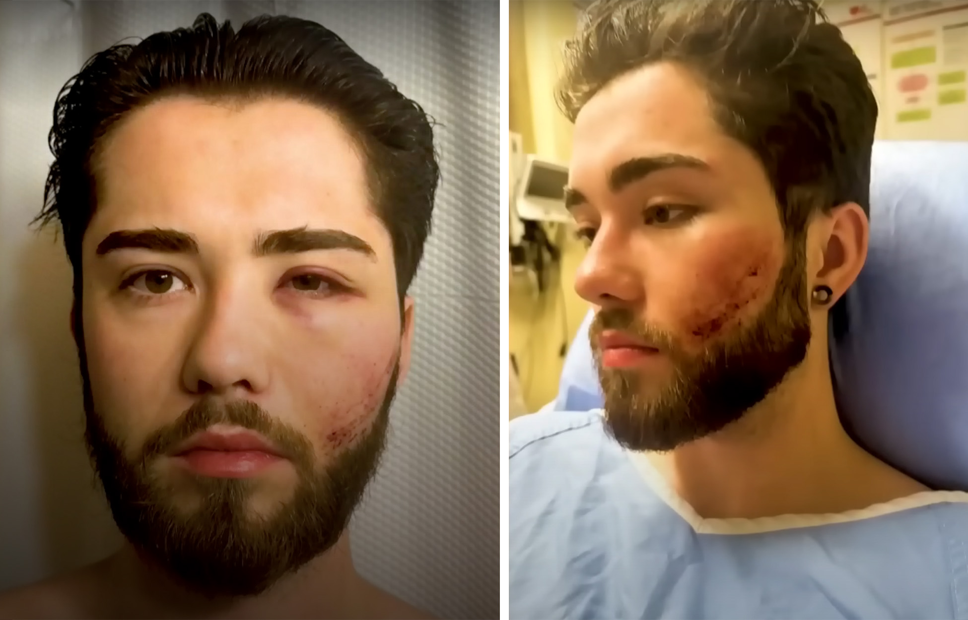 A Hiker Says He Was Attacked by a Cougar. Officials Say It Never