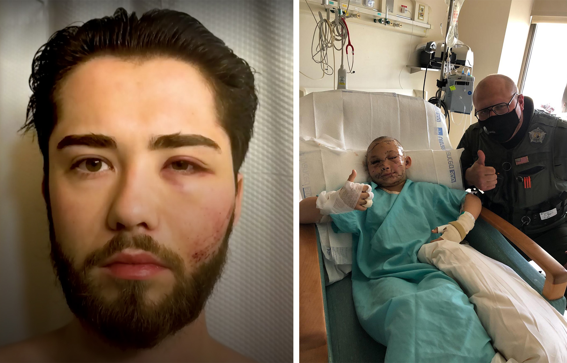 A Canadian man recovers in a hospital after claiming he was attacked by a cougar; a 9-year-old cougar attack victim in Washington State.
