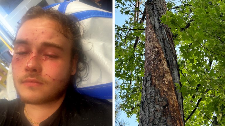 A teenager in a hospital bed; a tree that was struck by lightning.